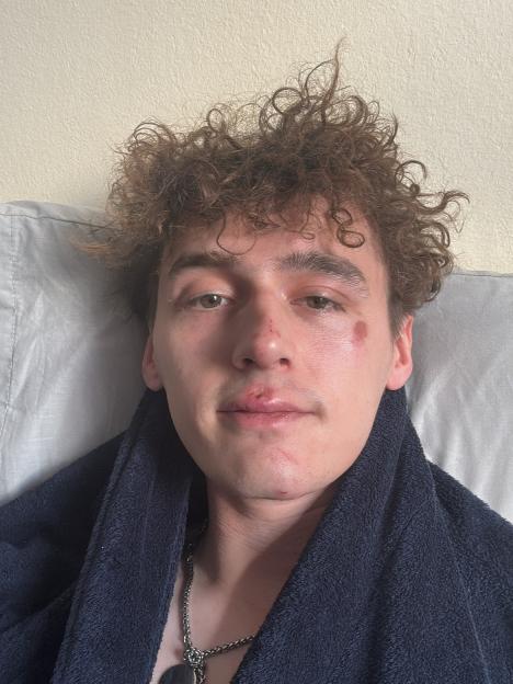 Big Brother Champion Left Injured Following Shocking Assault