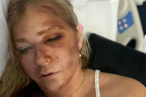 Prince Andrew ‘not surprised’ his accuser Virginia Giuffre shared shocking ‘4 days to live’ post after crash, pals say
