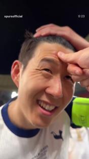 Son showing off head scar from hitting Europa League trophy.
