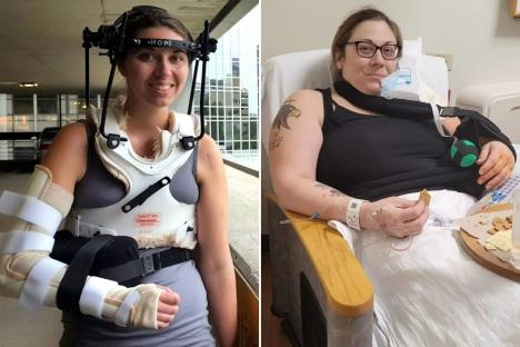 Doctors reattach ‘internally decapitated’ woman’s HEAD after her skull became detached from her spine in football injury
