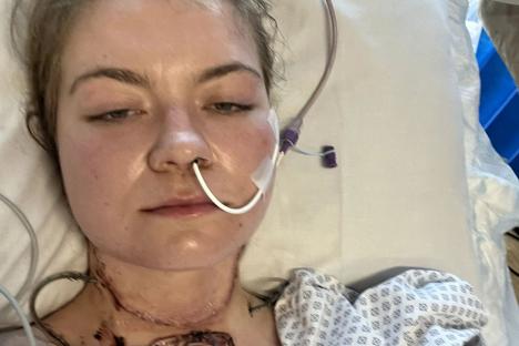 I thought my mouth ulcer was work stress but it was killer disease – my new tongue’s made from skin from my tattooed arm