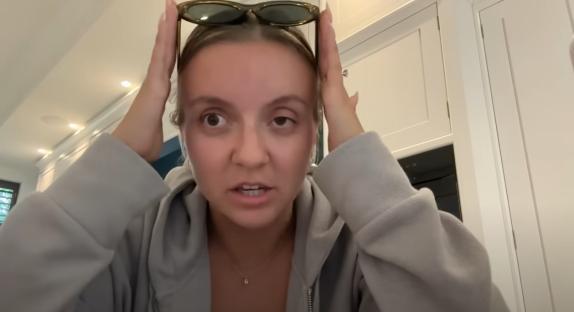 Woman holding sunglasses above her head, describing a botched botox treatment.