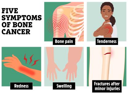 Illustration of five bone cancer symptoms: bone pain, tenderness, redness, swelling, and fractures after minor injuries.