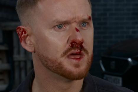 Watch the moment Coronation Street’s Gary Windass is left dripping in blood after explosive fight with new arch enemy