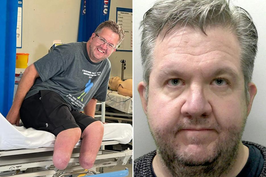 Patients of surgeon who froze OWN legs to amputate them for sex fantasy fear they were victims of unnecessary ops