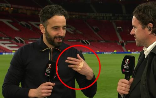 Post-match interview with a man who has a bandage on his hand.