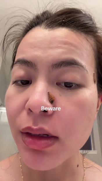 Person with pimple patches on their face.