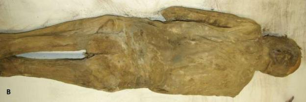 Mummified remains of an individual.
