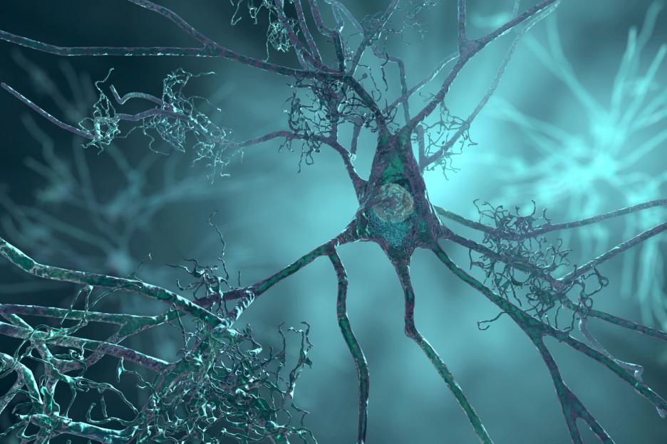 ‘Game-changing’ Alzheimer’s drug could STOP disease in its tracks – as the ‘most powerful weapon’ against condition yet