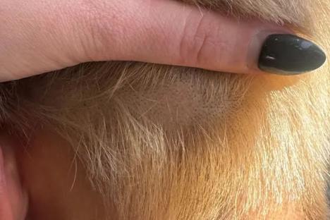 Love Island star reveals her alopecia has returned and she shares new hair loss snap