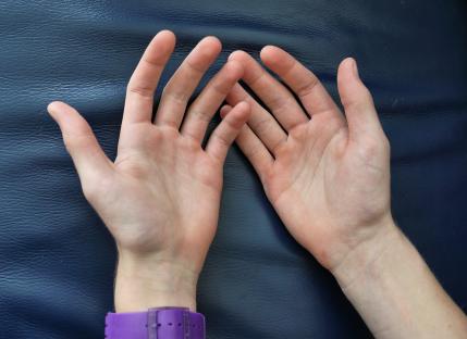 The simple 30-second finger test that can reveal your risk of devastating incurable disease