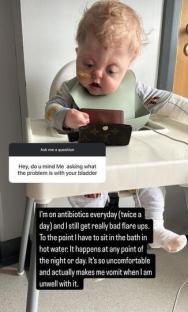 Toddler in high chair describing bladder problems in Instagram Q&A.