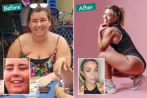 I lost 100lbs and my excess skin WITHOUT fat jabs – I went from a dress size 22 to 10, here’s how