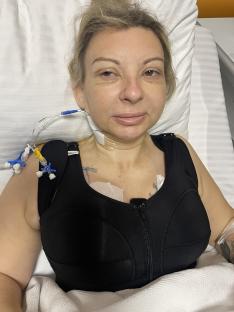I spent £7k on ‘mummy makeover’ surgery but I look better fat – it feels like I’m ripped in HALF from painful stitches