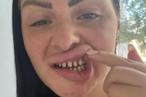 I was so insecure I spent £4.5k getting perfect Turkey teeth – it was so painful I cried & trolls say my smile’s ruined