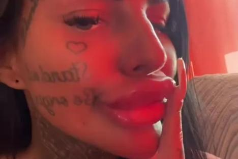 I’m so obsessed with filler that my huge lips touch my nose – trolls can’t understand what I’m saying, but I don’t care