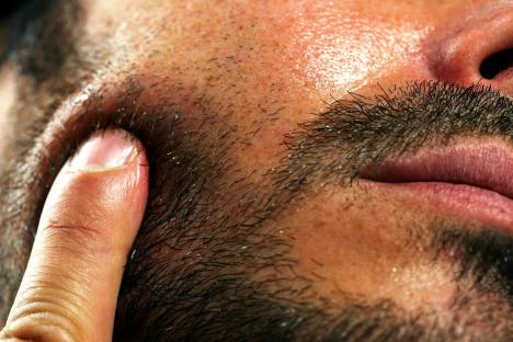 Man, 33, who got ‘puffy face when he was hungover’ eventually diagnosed with life-threatening ‘swollen heart’