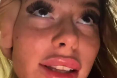 I became obsessed with looking fake – then I had the ultimate glow-down & people say I look 10 years younger