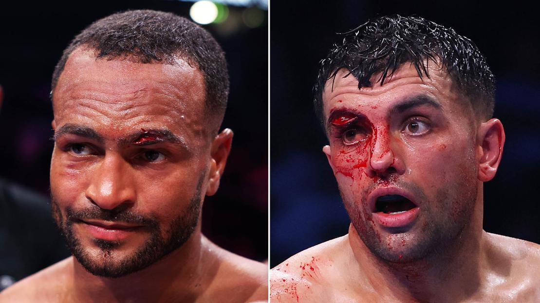 Jack Catterall ‘will need plastic surgery’ after ‘one of worst cuts ever’ sees Harlem Eubank fight called off