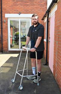 Man with spinal tumor using a walking frame.