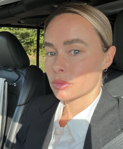 Leah Tyrer, a Married at First Sight UK star, shown before fillers and a glam show makeover.