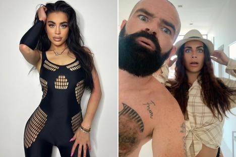 Fuming Love Island star Katie Salmon reveals her daughter’s medical condition as she hits back at comments on her face