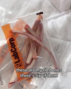 Six rib bones in a plastic bag.