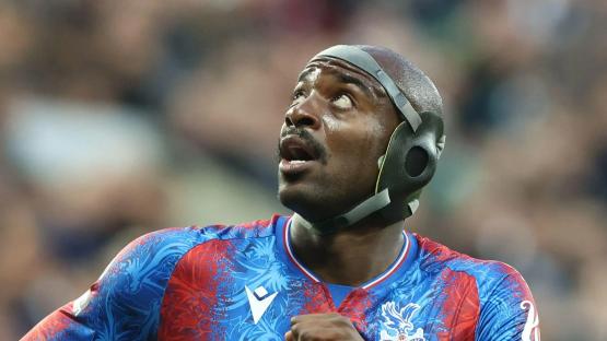 What is Jean-Philippe Mateta wearing on his head?