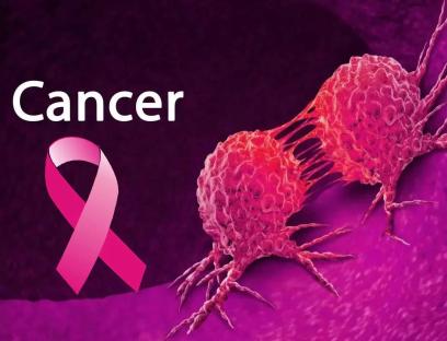 Sugary drinks, refined carbohydrates, processed meats, major causes of cancer – Varsity Don
