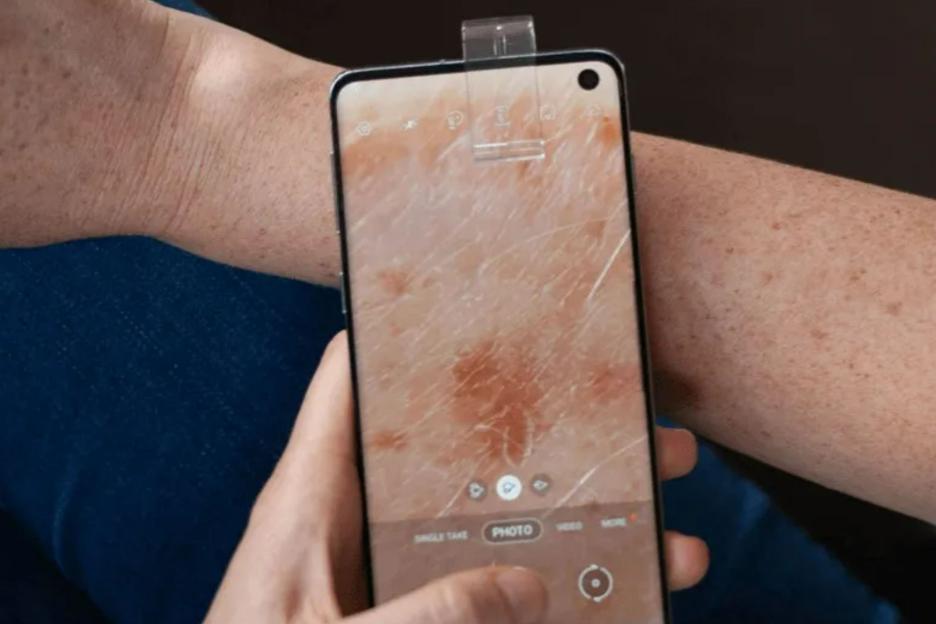 New at-home phone app could spot deadly cancer as cases reach all-time high