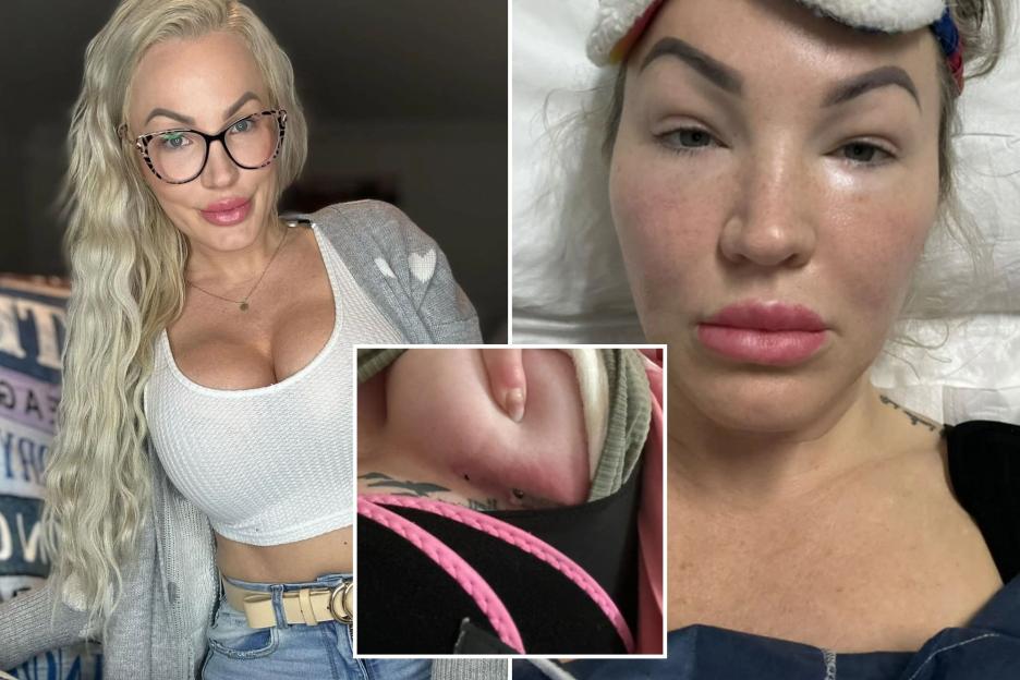 I spent £5k on a Turkey BBL, boob job, lipo & designer vagina – I thought it’d boost my career instead I got butchered