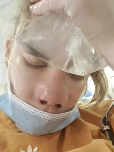 Woman holding ice pack to face after botched dental implants.