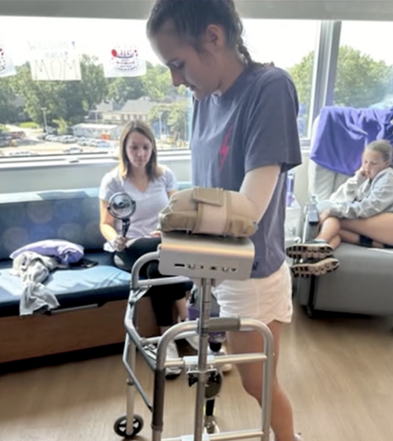 Teen shark attack survivor Lulu Gribbin using a walker with a prosthetic leg.