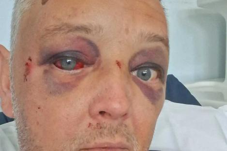 I was left with a fractured skull and brain damage after ‘random’ attack on night out… then I got a chilling message