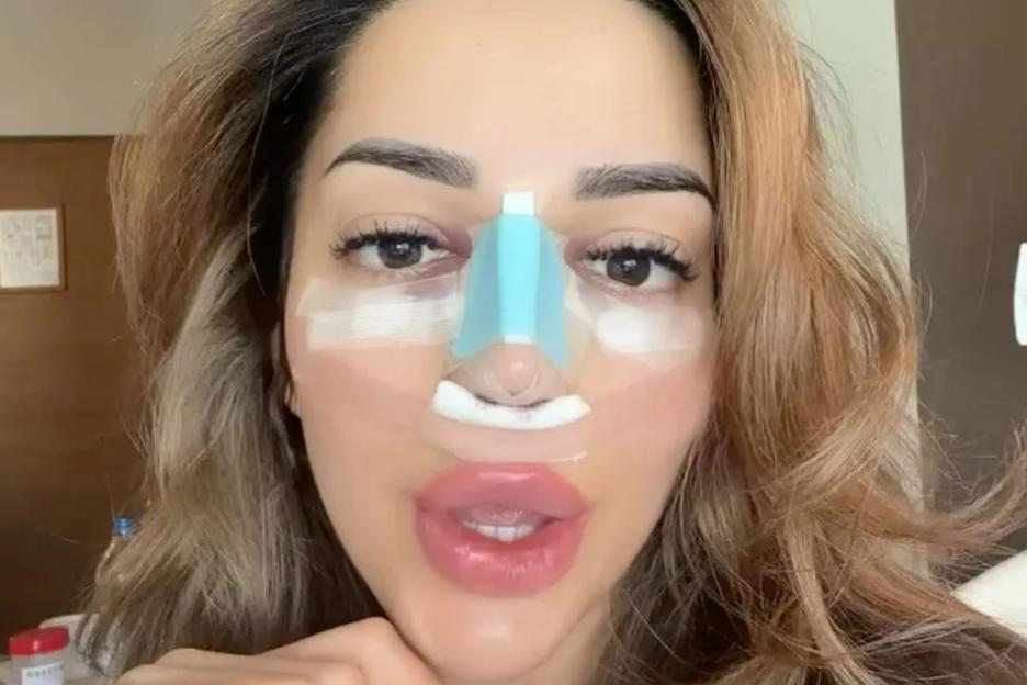 Watch as Love Island’s Tanyel Revan reveals the result of her nose job surgery to look like ‘a bad b***h’