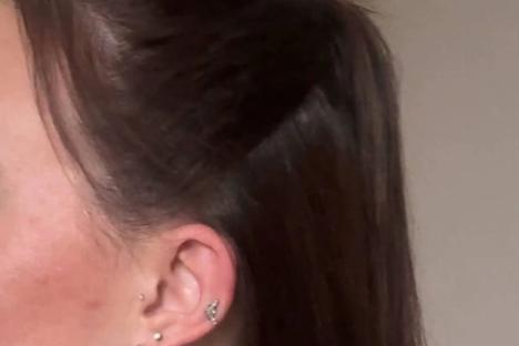 I was suffering with hair loss but doctors couldn’t give me answers… a special ‘syrup’ made it grow back in 2 months