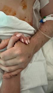 Close-up of two hands clasped together; one hand shows injuries.
