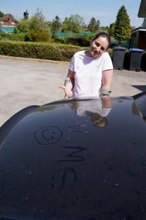Woman with arm brace leaning on car with dust drawing of a smiley face.