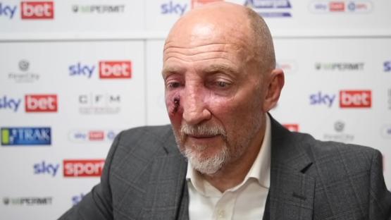 Iconic manager Ian Holloway suffers horror swelling on face after skin cancer scare as concerned fans send well wishes
