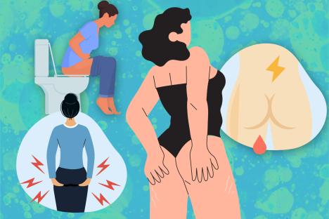 The 6 signs of bum cancer often mistaken for less serious conditions – as experts warn of surging cases