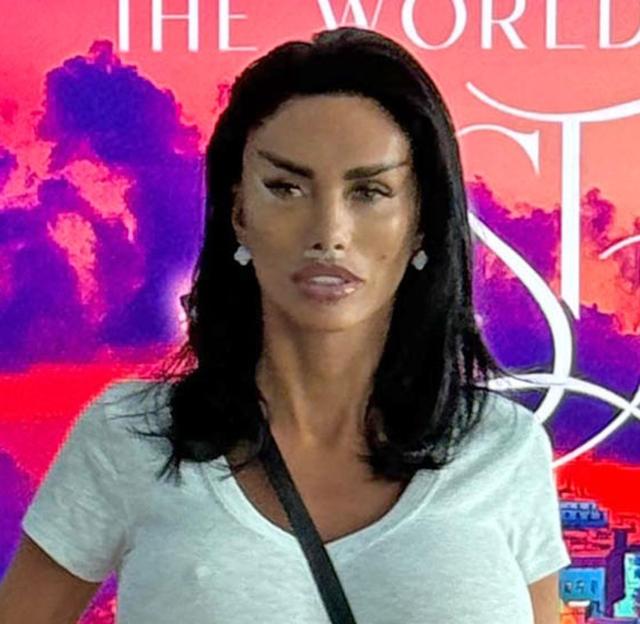 Katie Price at Istanbul Airport after cosmetic surgery.