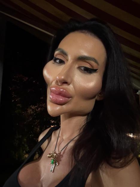 Woman spends 10 years getting the ‘world’s biggest cheeks’ – now her ‘before’ photos are shocking the internet