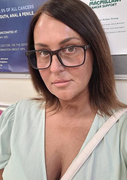 Photo of Sharon Moreby, who had half her tongue removed due to misdiagnosed cancer.
