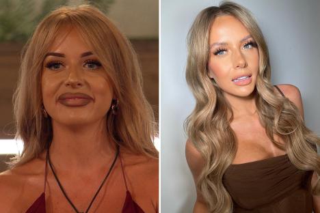 Inside the celeb glow-down trend as they get filler dissolved – and Love Island’s Faye warns about botched Botox