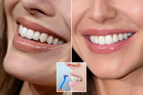 I’m a dentist and most clients ask for the same two celebrity smiles – there’s a £4 treatment that will achieve it