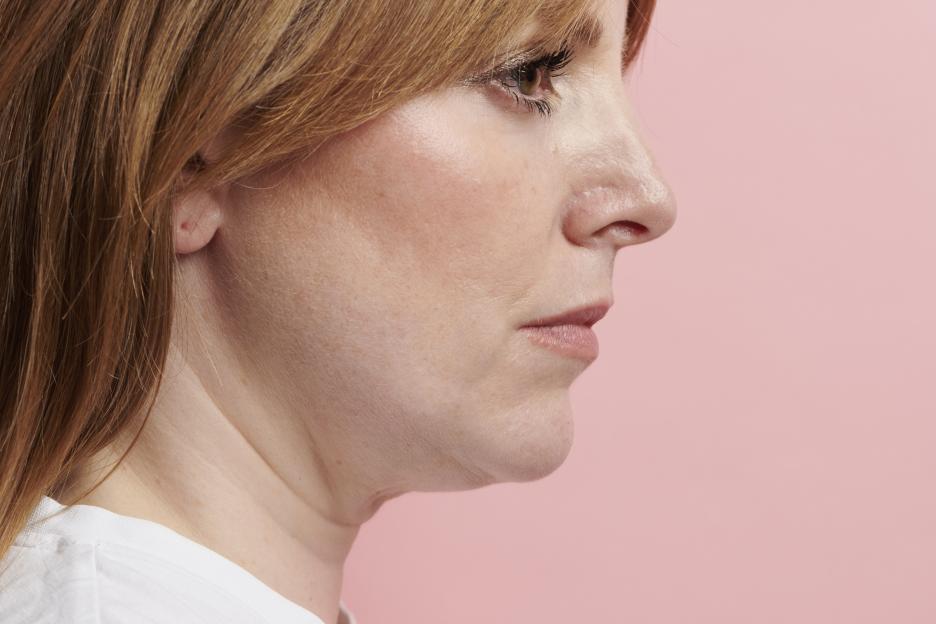 Side profile of Beth King's face and neck, showing creped skin and jowls.