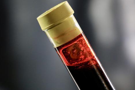 Blood sample in a test tube.