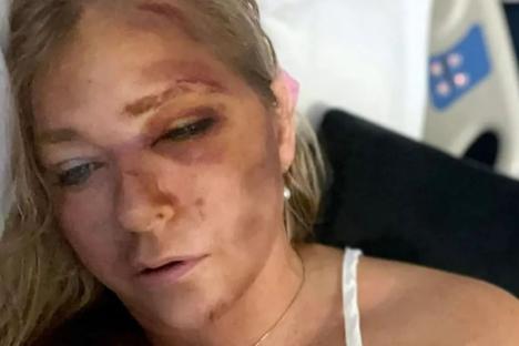 Parents of kids on bus in Prince Andrew accuser Virginia Giuffre’s ‘near fatal’ crash break silence & attack her ‘lies’