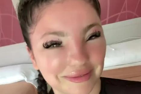 I thought I’d get a tan but woke up with sun poisoning – I looked just like an Avatar thanks to my swollen eyes