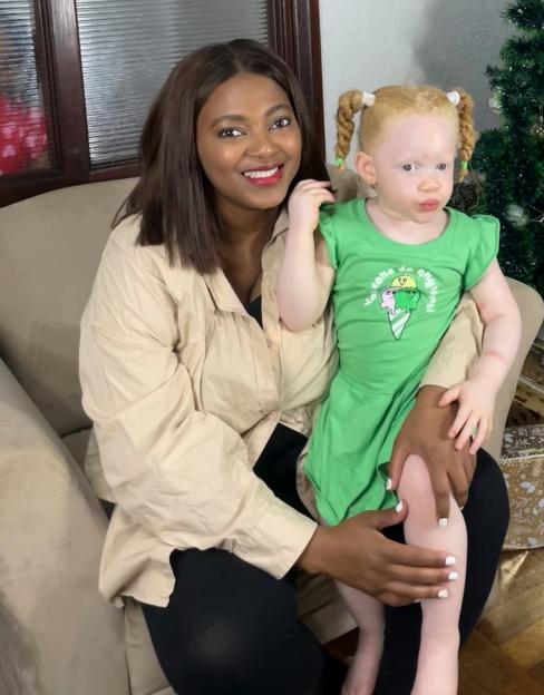 A Black mother holds her young daughter, who has albinism, near a Christmas tree.
